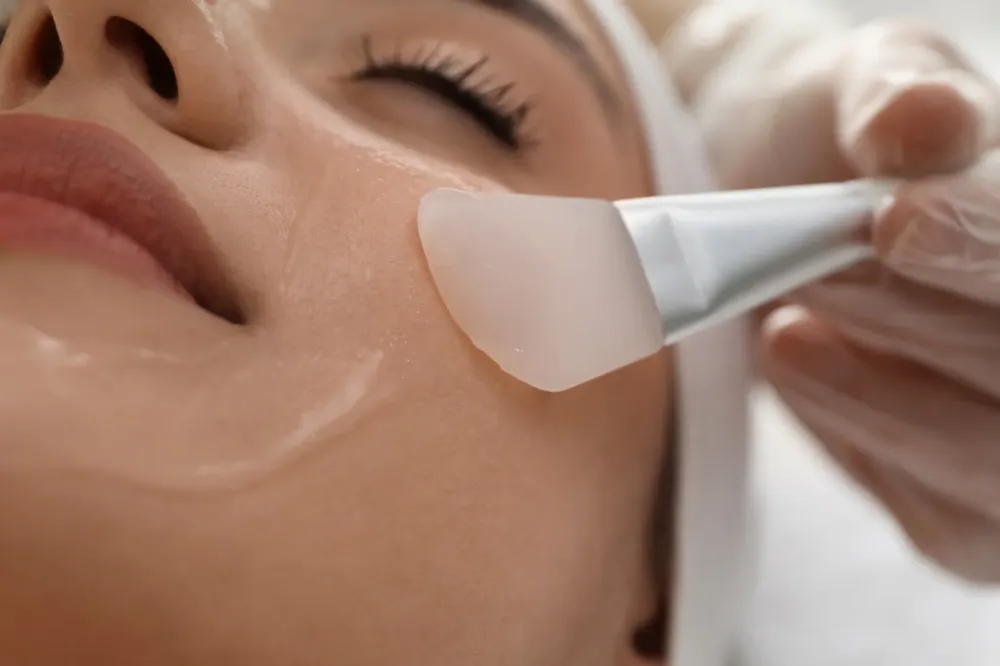 Peeling (1)